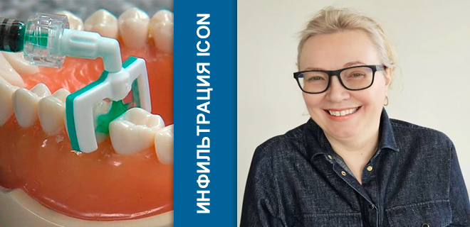 Изображение Герасимова Элла. Практический семинар: ICON – лечение начальных этапов развития кариеса методом инфильтрации. 16.03.26 в 11:00 № 4